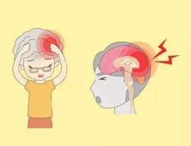 年轻人应如何预防脑梗问题？