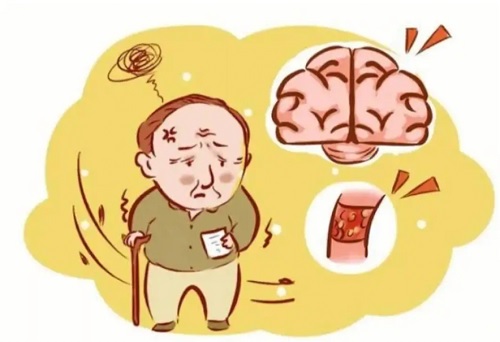 怎么做预防老年人脑血栓问题？